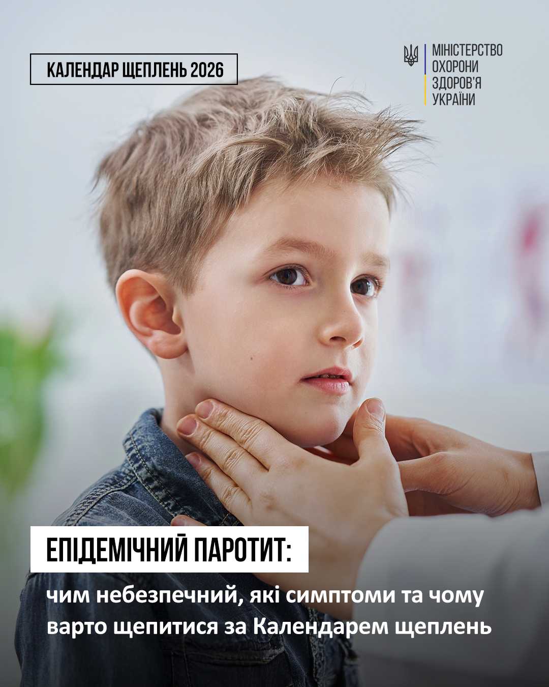Епідемічний паротит: чим небезпечний, які симптоми та чому варто щепитися за Календарем щеплень