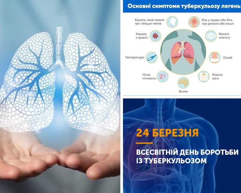 Місячник боротьби з туберкульозом. Березень 2026